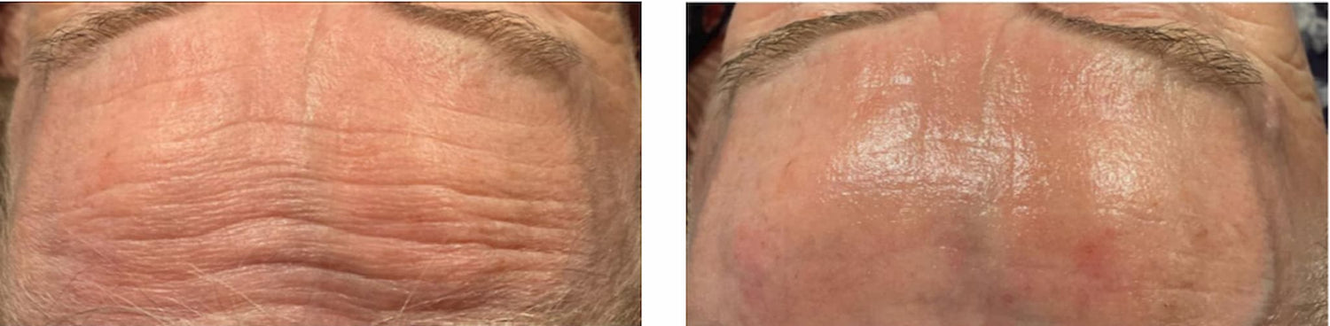 Caviar Peptide Peel für reife und sehr sensible Hauttypen ekseption 70ml