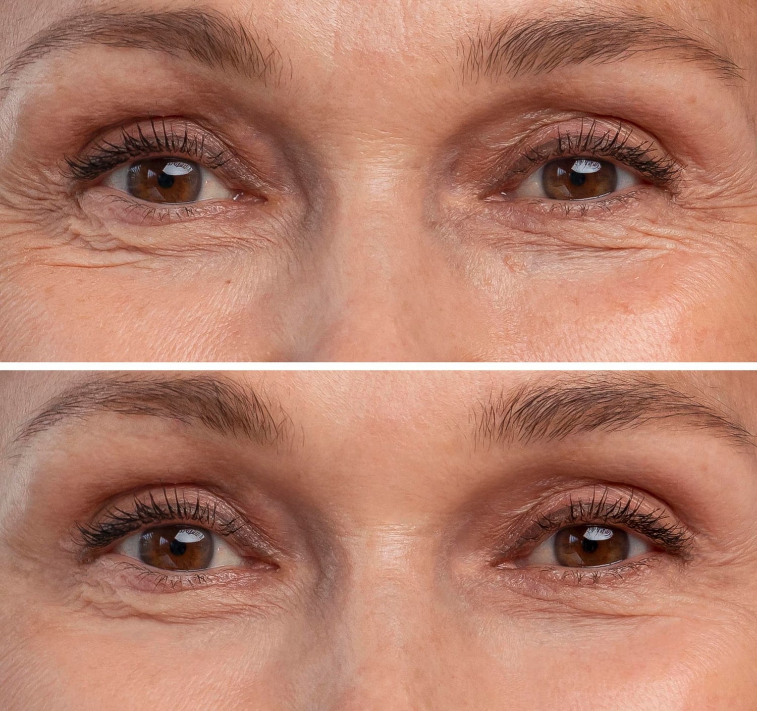 F-Eye Glow hochreine Wirkstoffe in sterilen Vials gezielte Pflege für die empfindliche Augenpartie Fusion Mesp 5 x 3ml