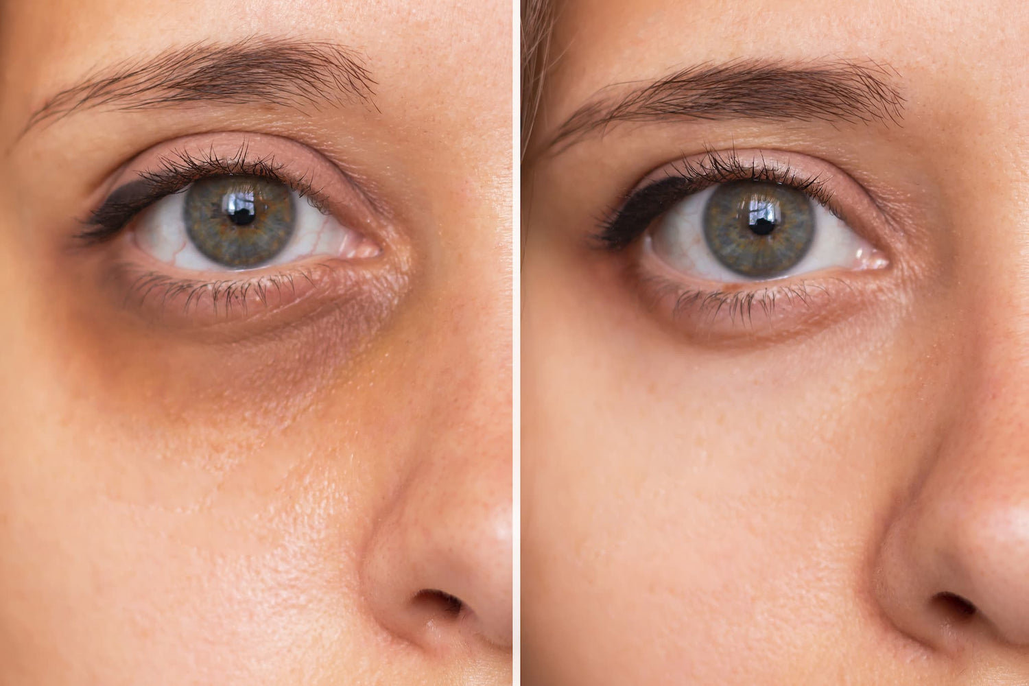 Eye Sorbet erfrischende Pflege mit Applikator Fusion Meso 30 ml